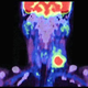 Illustration for article titled The Healing Power Of Antimatter